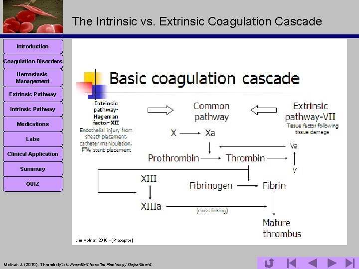 The Intrinsic vs. Extrinsic Coagulation Cascade Introduction Coagulation Disorders Hemostasis Management Extrinsic Pathway Intrinsic