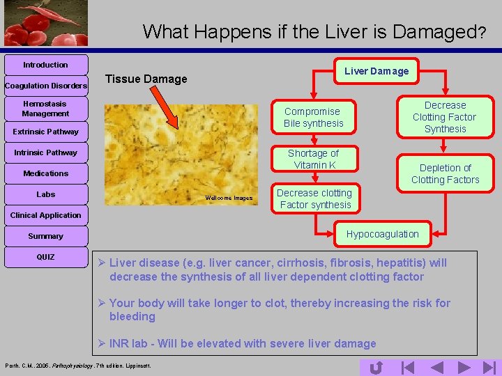 What Happens if the Liver is Damaged? Introduction Coagulation Disorders Liver Damage Tissue Damage