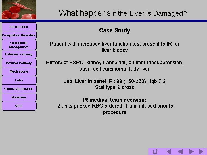 What happens if the Liver is Damaged? Introduction Coagulation Disorders Hemostasis Management Extrinsic Pathway