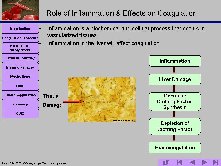 Role of Inflammation & Effects on Coagulation Introduction • Coagulation Disorders Hemostasis Management •