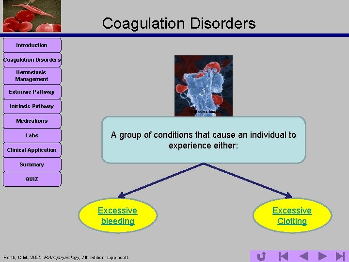 Coagulation Disorders Introduction Coagulation Disorders Hemostasis Management Extrinsic Pathway Intrinsic Pathway Wellcome Images Medications