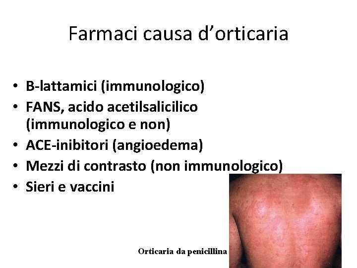 Farmaci causa d’orticaria • B-lattamici (immunologico) • FANS, acido acetilsalicilico (immunologico e non) •
