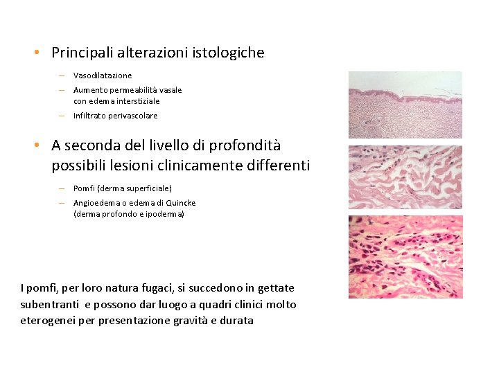 Istopatologia • Principali alterazioni istologiche – Vasodilatazione – Aumento permeabilità vasale con edema interstiziale