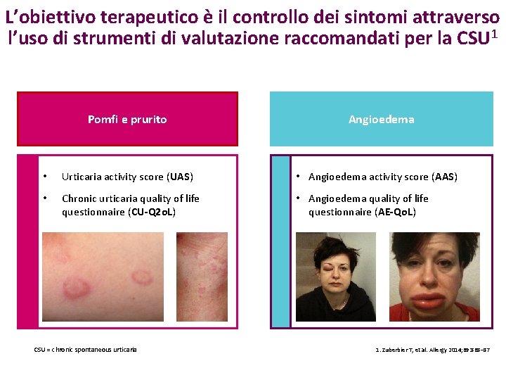 L’obiettivo terapeutico è il controllo dei sintomi attraverso l’uso di strumenti di valutazione raccomandati