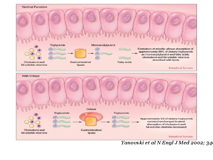 Yanovski et al N Engl J Med 2002; 346 