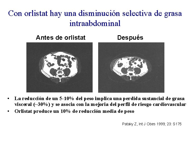 Con orlistat hay una disminución selectiva de grasa intraabdominal Antes de orlistat Después •