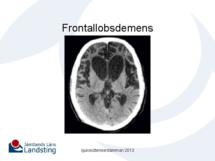 Frontallobsdemens sjuksköterskestämman 2013 