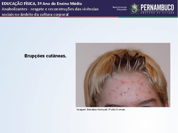 EDUCAÇÃO FÍSICA, 3º Ano do Ensino Médio Anabolizantes - resgate e reconstruções das vivências