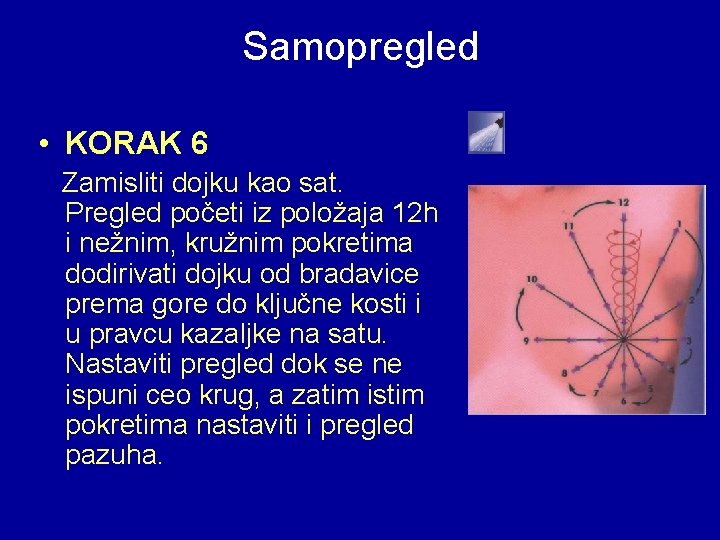 Samopregled • KORAK 6 Zamisliti dojku kao sat. Pregled početi iz položaja 12 h