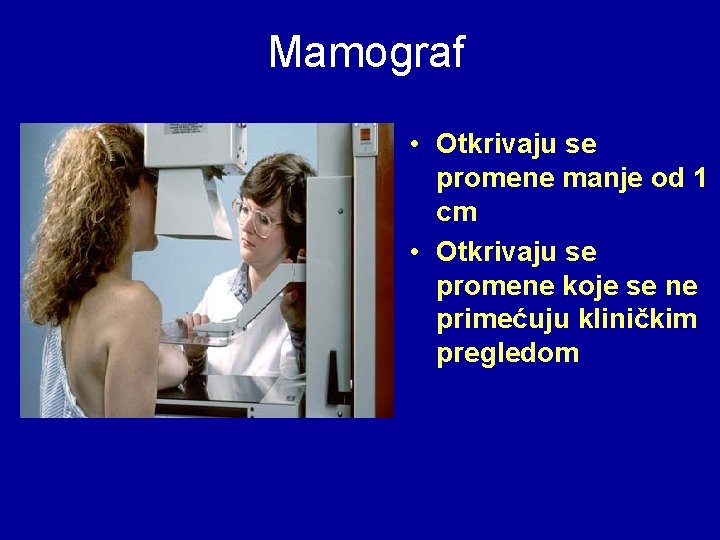 Mamograf • Otkrivaju se promene manje od 1 cm • Otkrivaju se promene koje