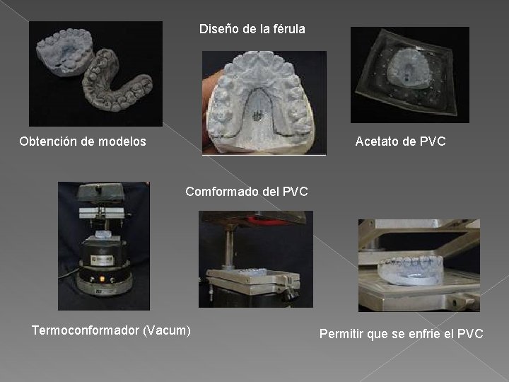 Diseño de la férula Obtención de modelos Acetato de PVC Comformado del PVC Termoconformador