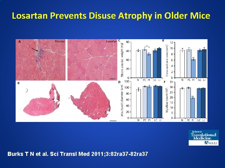 Losartan Prevents Disuse Atrophy in Older Mice Burks T N et al. Sci Transl
