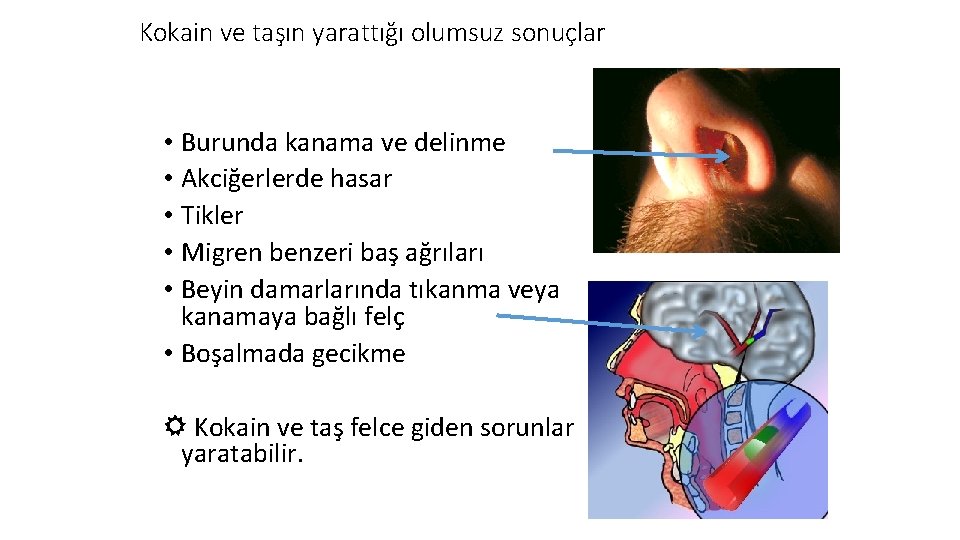 Kokain ve taşın yarattığı olumsuz sonuçlar • Burunda kanama ve delinme • Akciğerlerde hasar