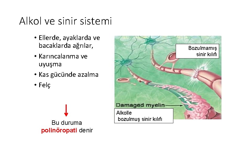 Alkol ve sinir sistemi • Ellerde, ayaklarda ve bacaklarda ağrılar, • Karıncalanma ve uyuşma