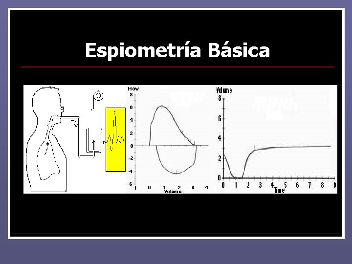 Espiometría Básica Espiometría Básica