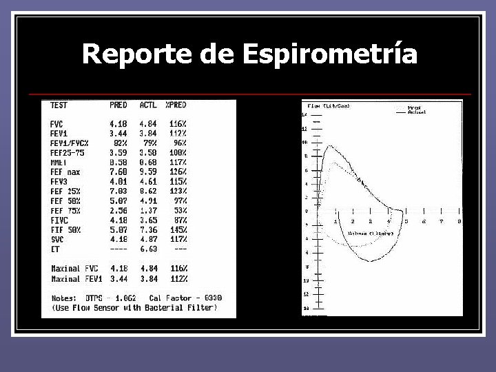 Reporte de Espirometría Reporte de Espirometría
