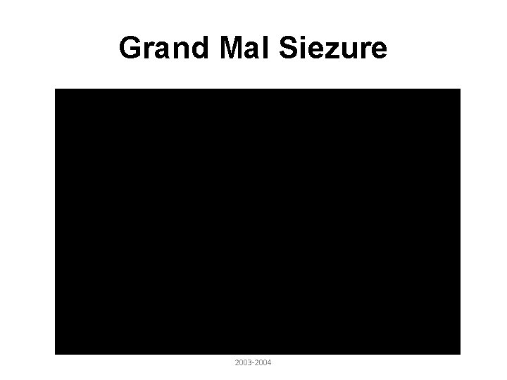 Grand Mal Siezure 2003 -2004 