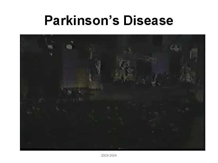 Parkinson’s Disease 2003 -2004 