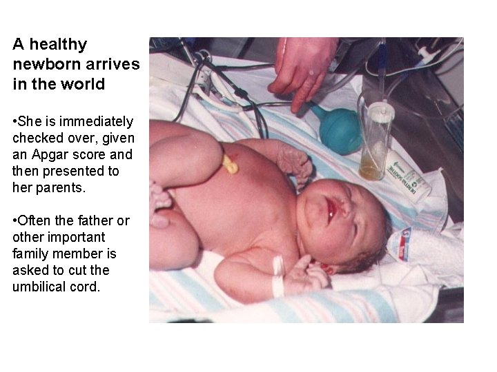 A healthy newborn arrives in the world • She is immediately checked over, given A healthy newborn arrives in the world • She is immediately checked over, given
