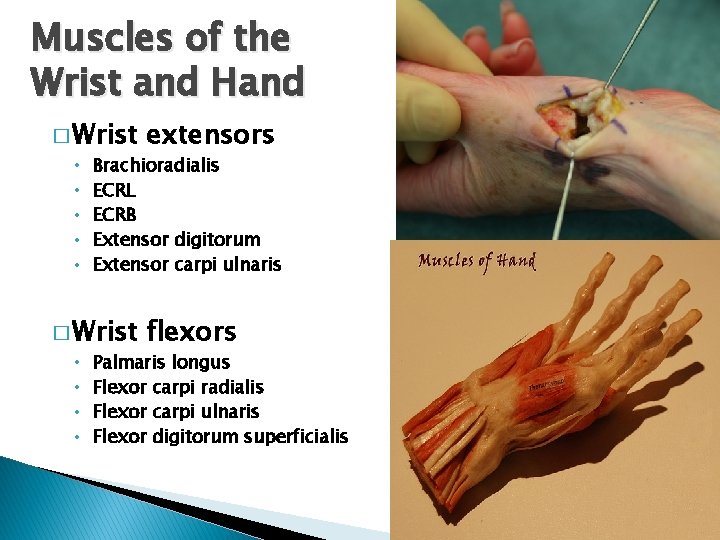 Muscles of the Wrist and Hand � Wrist extensors • Brachioradialis • ECRL •