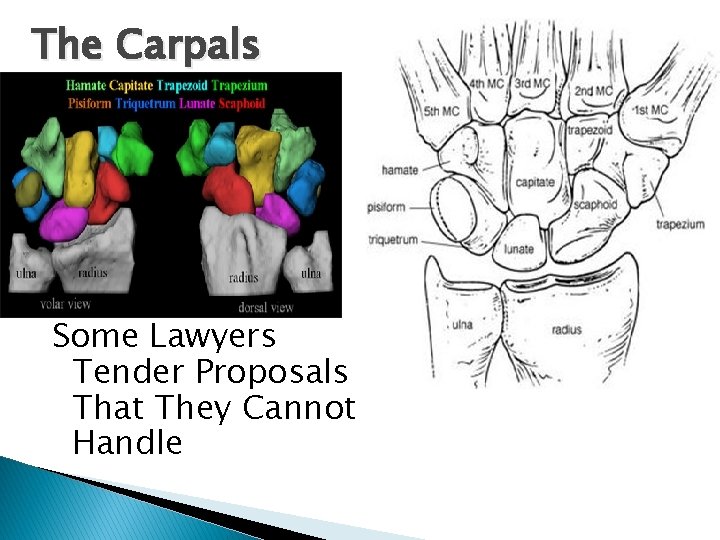 The Carpals Some Lawyers Tender Proposals That They Cannot Handle 