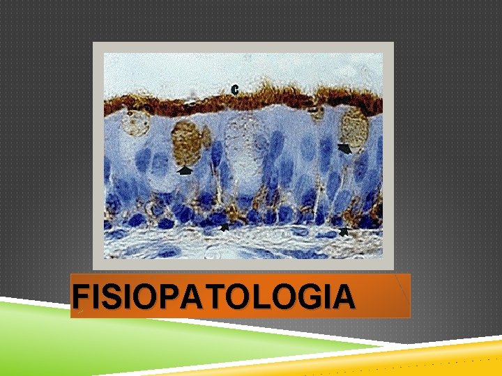 FISIOPATOLOGIA 