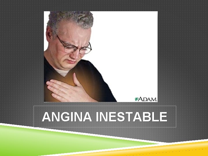 ANGINA INESTABLE 