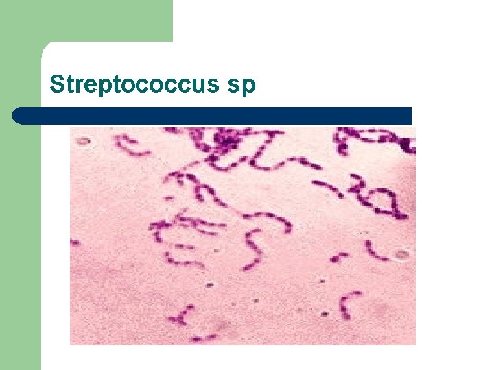 Streptococcus sp 