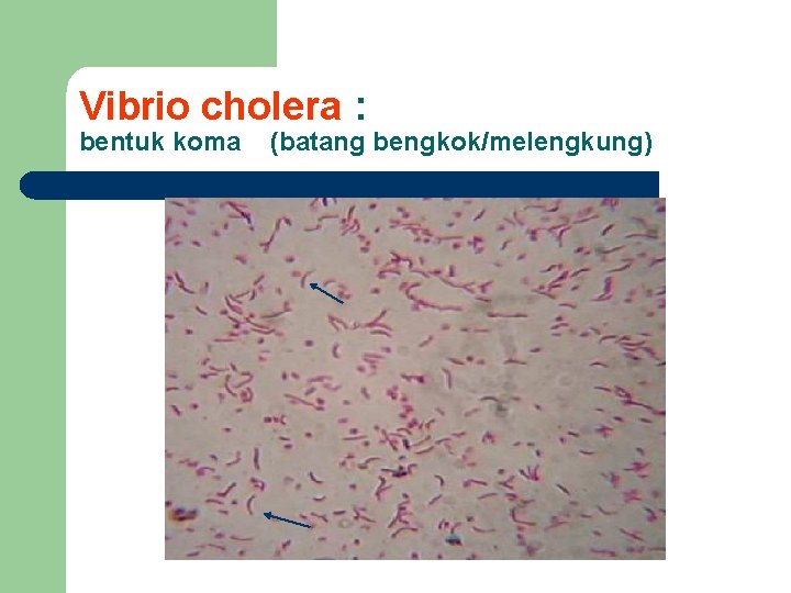 Vibrio cholera : bentuk koma (batang bengkok/melengkung) 