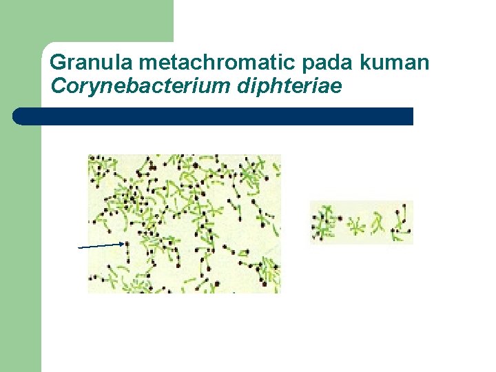 Granula metachromatic pada kuman Corynebacterium diphteriae 