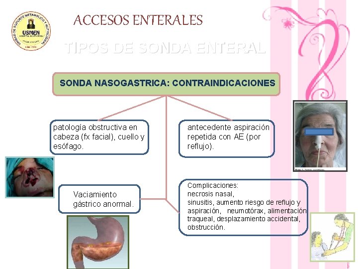 ACCESOS ENTERALES TIPOS DE SONDA ENTERAL SONDA NASOGASTRICA: CONTRAINDICACIONES patología obstructiva en cabeza (fx