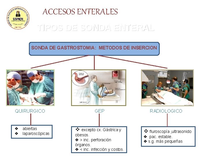 ACCESOS ENTERALES TIPOS DE SONDA ENTERAL SONDA DE GASTROSTOMIA: METODOS DE INSERCION QUIRURGICO v