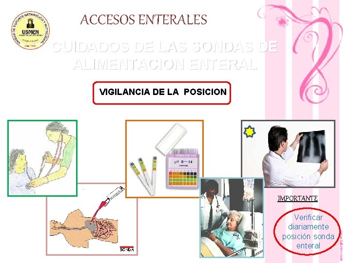 ACCESOS ENTERALES CUIDADOS DE LAS SONDAS DE ALIMENTACION ENTERAL VIGILANCIA DE LA POSICION IMPORTANTE