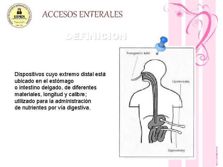 ACCESOS ENTERALES DEFINICION Dispositivos cuyo extremo distal está ubicado en el estómago o intestino