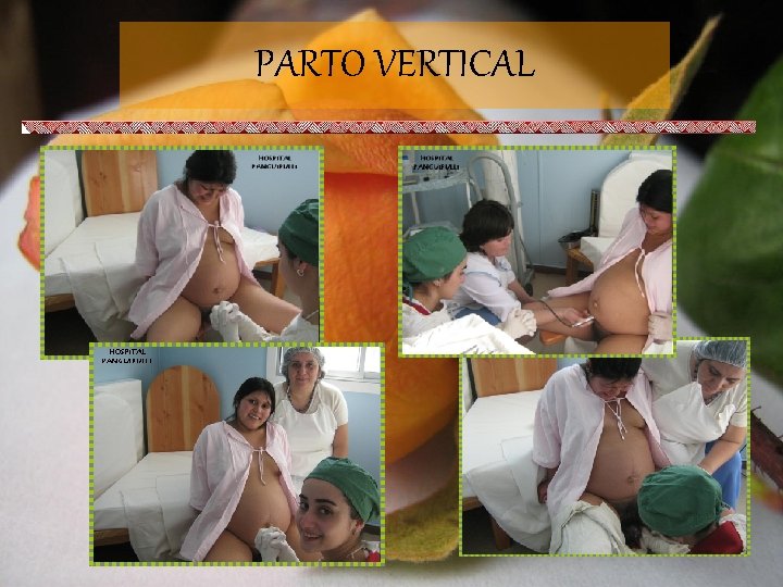 PARTO VERTICAL 