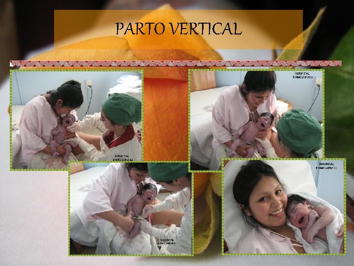 PARTO VERTICAL 