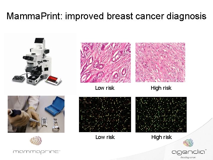 Mamma. Print: improved breast cancer diagnosis Low risk High risk 