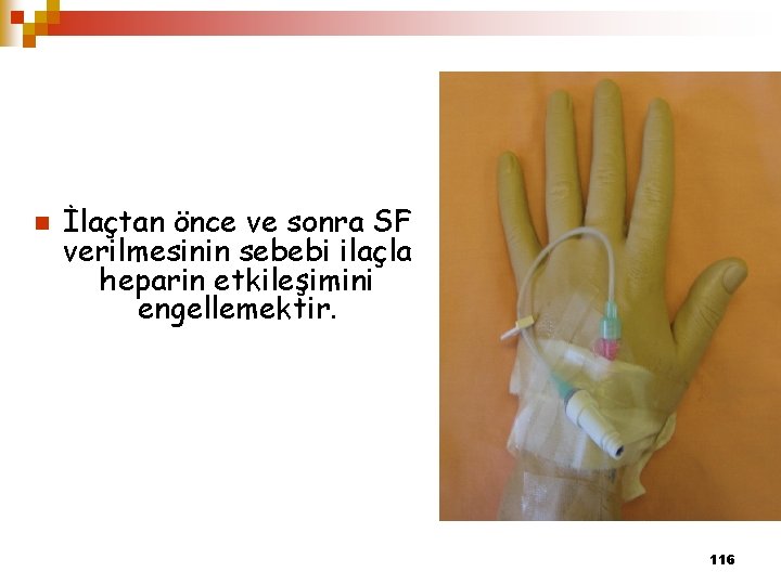 n İlaçtan önce ve sonra SF verilmesinin sebebi ilaçla heparin etkileşimini engellemektir. 116 