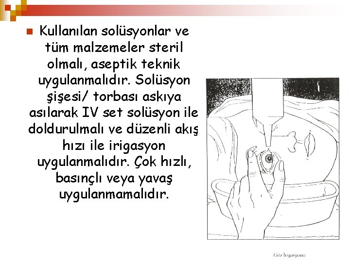 Kullanılan solüsyonlar ve tüm malzemeler steril olmalı, aseptik teknik uygulanmalıdır. Solüsyon şişesi/ torbası askıya