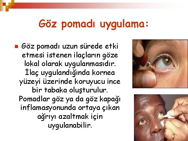 Göz pomadı uygulama: n Göz pomadı uzun sürede etki etmesi istenen ilaçların göze lokal