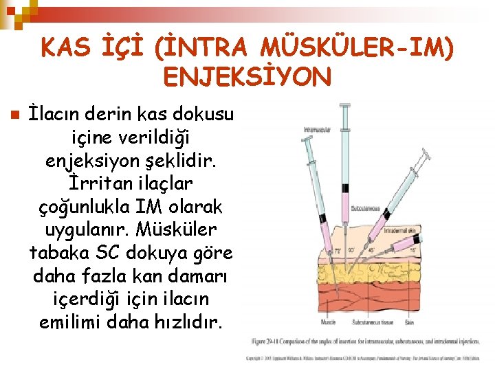 KAS İÇİ (İNTRA MÜSKÜLER-IM) ENJEKSİYON n İlacın derin kas dokusu içine verildiği enjeksiyon şeklidir.