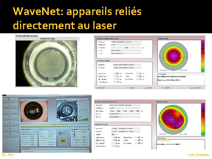 Wave. Net: appareils reliés directement au laser Dr. YEH CHR-Citadelle 