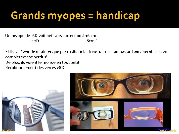 Grands myopes = handicap Un myope de -6 D voit net sans correction à