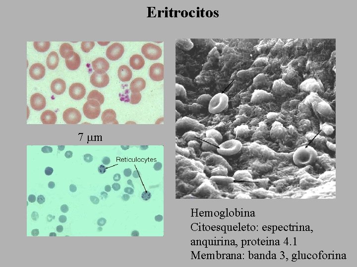 Eritrocitos 7 mm Hemoglobina Citoesqueleto: espectrina, anquirina, proteina 4. 1 Membrana: banda 3, glucoforina