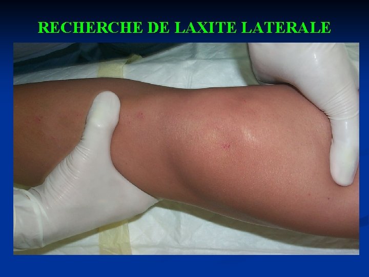 RECHERCHE DE LAXITE LATERALE 