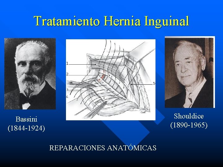 Tratamiento Hernia Inguinal Shouldice (1890 -1965) Bassini (1844 -1924) REPARACIONES ANATÓMICAS 