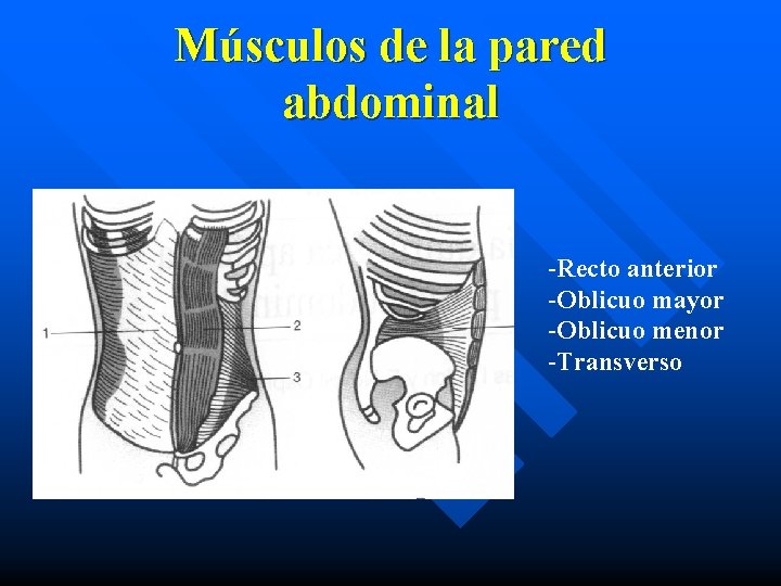 Músculos de la pared abdominal -Recto anterior -Oblicuo mayor -Oblicuo menor -Transverso 
