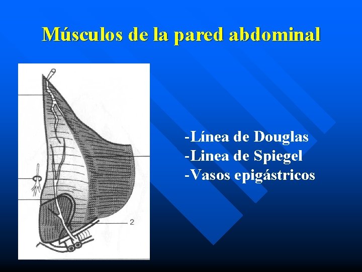 Músculos de la pared abdominal -Línea de Douglas -Linea de Spiegel -Vasos epigástricos 