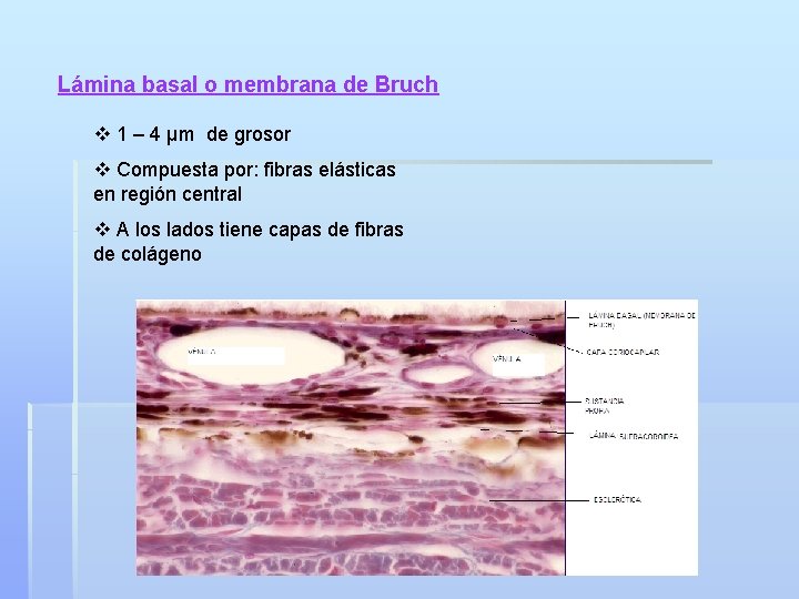 Lámina basal o membrana de Bruch v 1 – 4 µm de grosor v