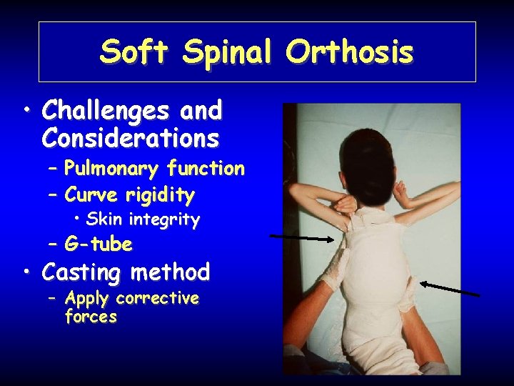 Soft Spinal Orthosis • Challenges and Considerations – Pulmonary function – Curve rigidity •